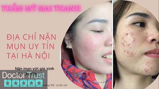 Phun Xăm Thẩm Mỹ - Mai Thanh - Beauty Spa Chương Mỹ Hà Nội