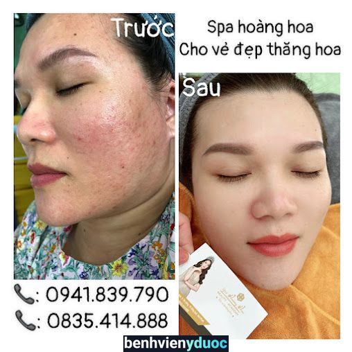 Spa hoàng hoa Đồng Xoài Bình Phước