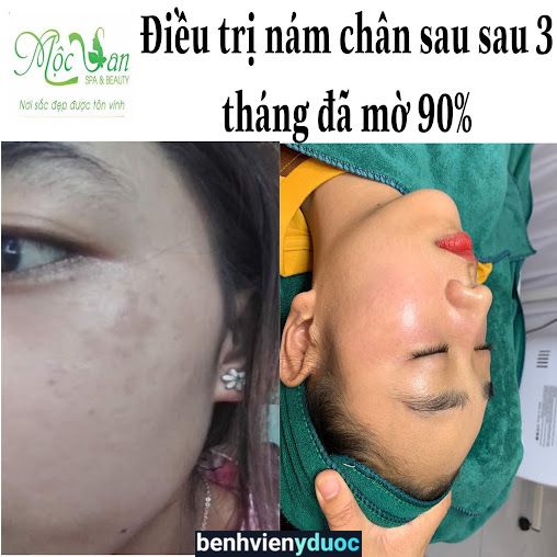 Spa Mộc San Hồng Bàng Hải Phòng