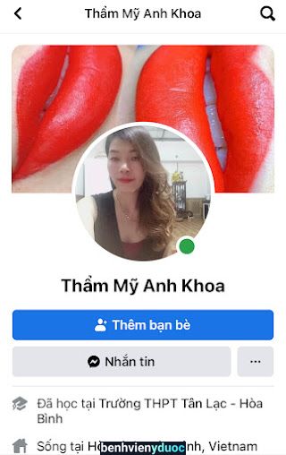 Thẩm mỹ anh khoa Tân Lạc Hòa Bình