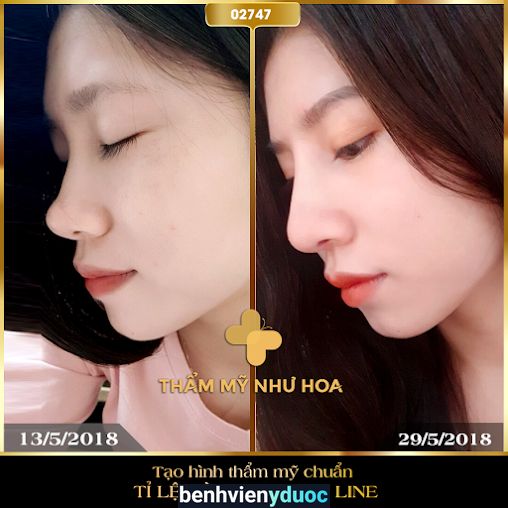 Thẩm Mỹ Như Hoa Cầu Giấy Hà Nội