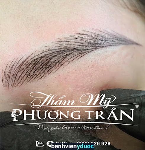 Thẩm Mỹ Phượng Trần Vĩnh Phúc Tam Dương Vĩnh Phúc