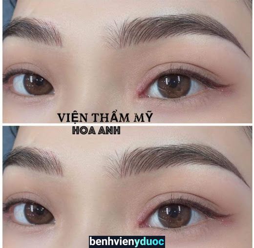 Thẩm Mỹ Viện HOA ANH KIÊN LƯƠNG Kiên Lương Kiên Giang