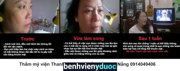 Thẩm Mỹ Viện Thanh Vân Đà Nẵng Thanh Khê Đà Nẵng