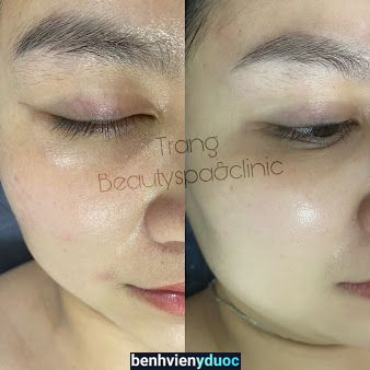 Trang Beauty spa Nam Định Nam Định