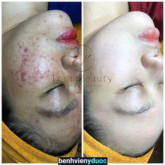 Trang Beauty Spa - Đồng xoài Đồng Xoài Bình Phước