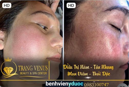 TRANGVENUS BEAUTY & SPA CENTER Hoài Đức Hà Nội