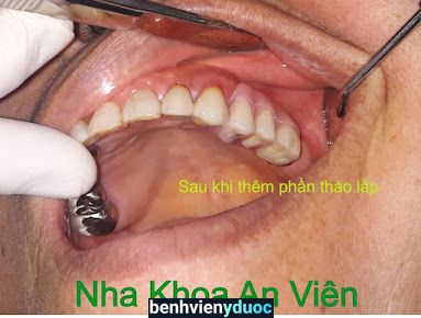 Trung Tâm Nha Khoa An Viên Bình Lục Hà Nam