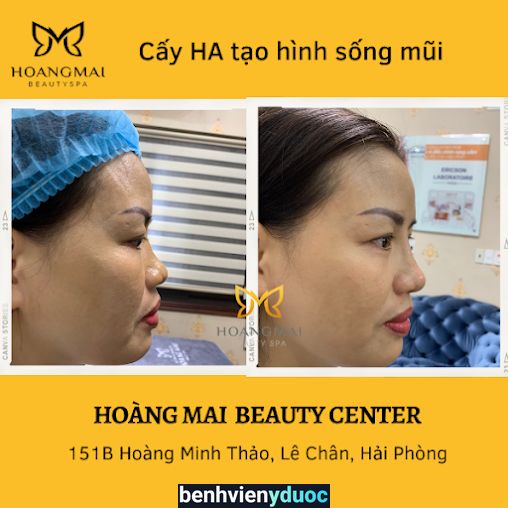 Viện thẩm mỹ công nghệ cao Hoàng Mai Lê Chân Hải Phòng