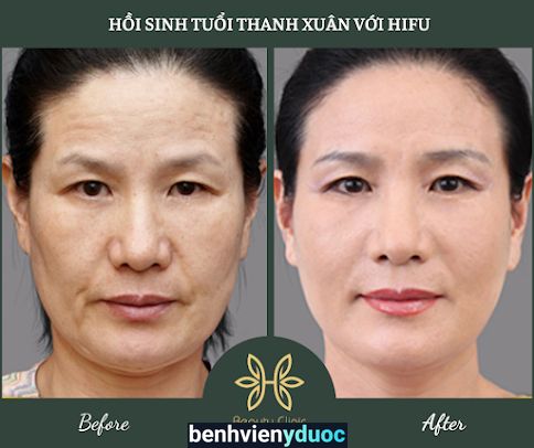 Viện Thẩm mỹ H. Beauty Clinic (Viện Thẩm mỹ Bs Hoàng) Hà Tĩnh Hà Tĩnh