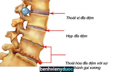 Xoa Bóp Bấm Huyệt Châm Cứu Bắc Từ Liêm Hà Nội